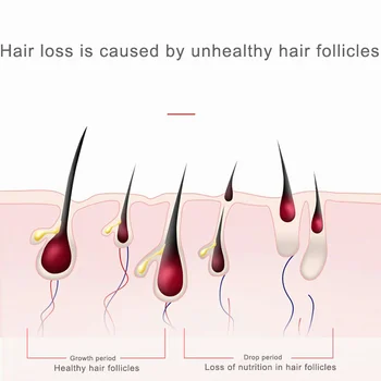 Stabdžių Plaukų Slinkimas Masažas LED Infraraudonųjų spindulių Terapija Vibracija, Jonai, Massager Teptuku Aliejus, Tonikas, Serumas Balionėlis EMS Šukos Plaukų Augimo